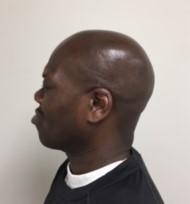 Mugshot Side